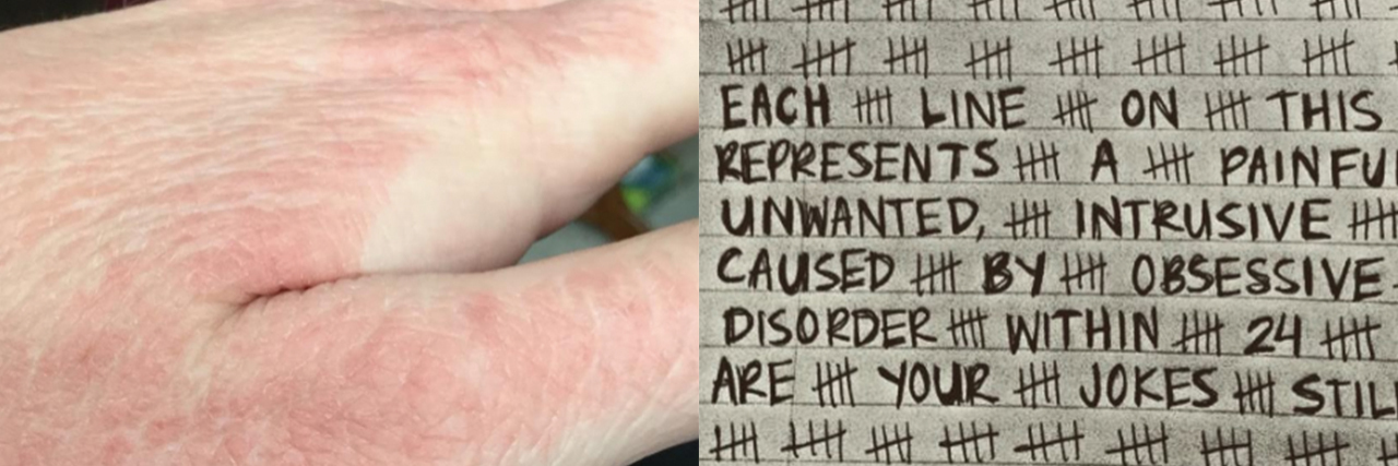 12 Pictures That Show the Different Ways OCD Manifests A picture of a red hand, and a picture of tally marks on a piece of paper