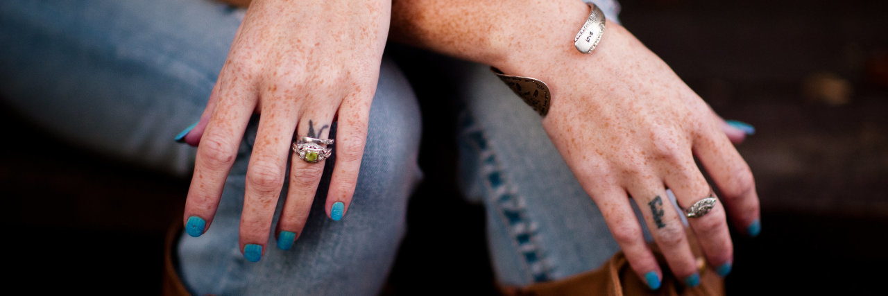 My Reality of Rheumatoid Arthritis at 32 A photo of the writer's hands crossed over her legs.