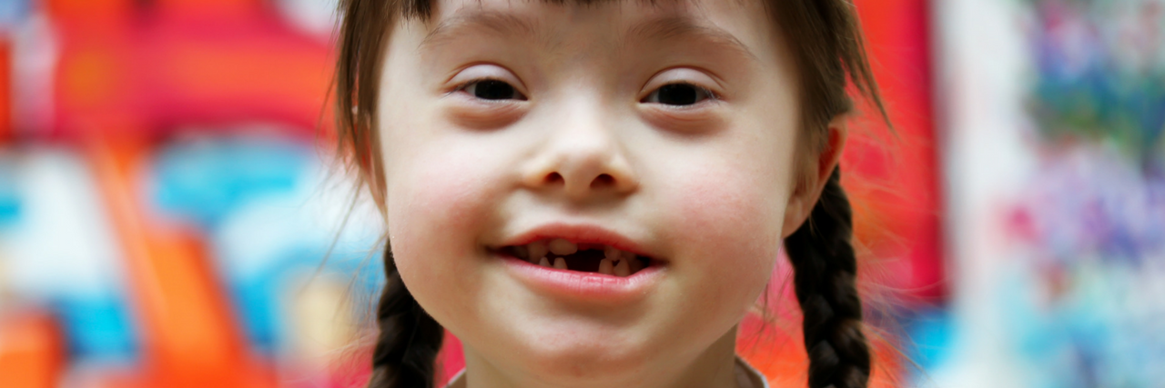 Down Syndrome Study Points to Immune System Dysfunction Girl with Down syndrome
