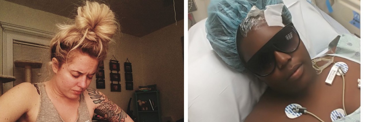 16 Photos That Show How Chronic Pain Manifests woman sitting on bed with eyes closed and hands on knees, and woman in hospital bed wearing sunglasses