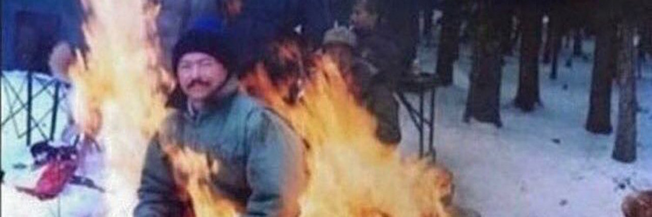 10 Symptoms of Ehlers-Danlos Syndrome, Described by Memes man sitting in fire with text hey how are you? good thanks