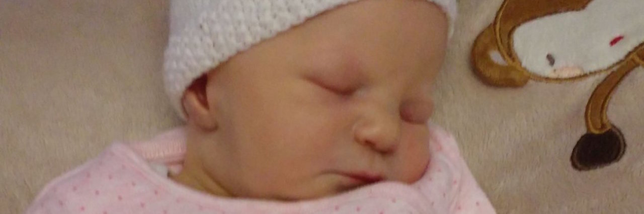 Parenting a Child With 3p25 Deletion Syndrome The author's daughter wearing a onesie that says "little sister"