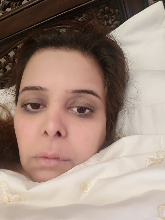 woman's face lying in bed