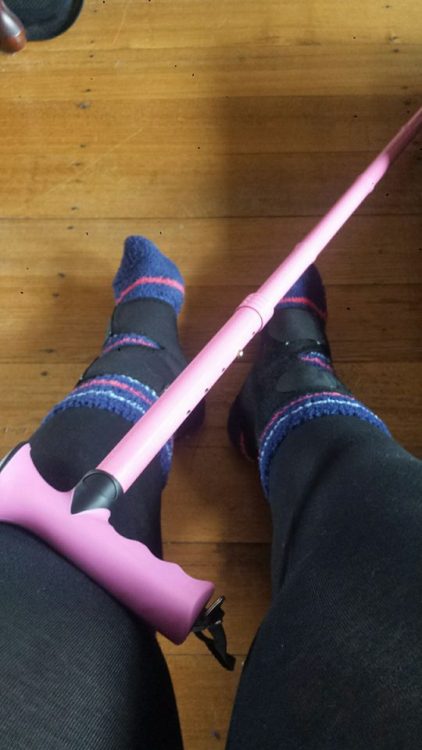 woman's legs wearing straps and braces with her pink cane leaning against her