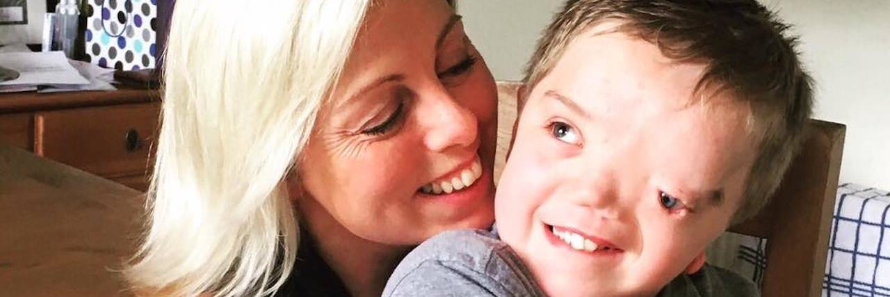 How to Help Children Understand Physical Differences Boy sitting on mom's lap