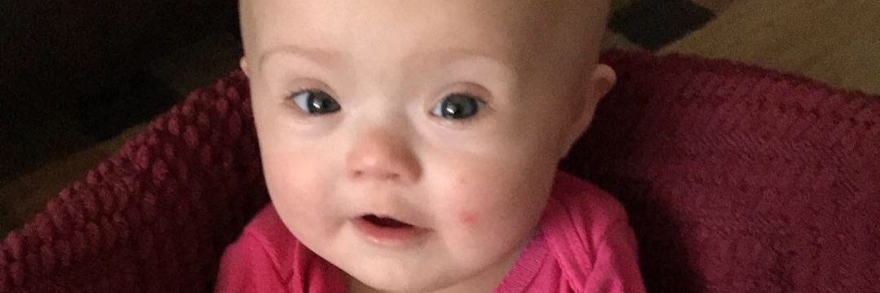 My Daughter With Down Syndrome Opened My Heart to Care for Others Little girl with Down syndrome