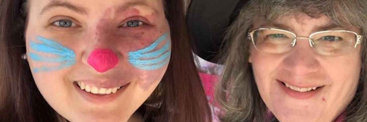 Lessons From My Daughter With a Facial Port-Wine Stain Birthmark Mother and daughter smiling at camera.