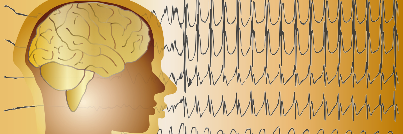 Telling Your Epilepsy Story Brain epilepsy.