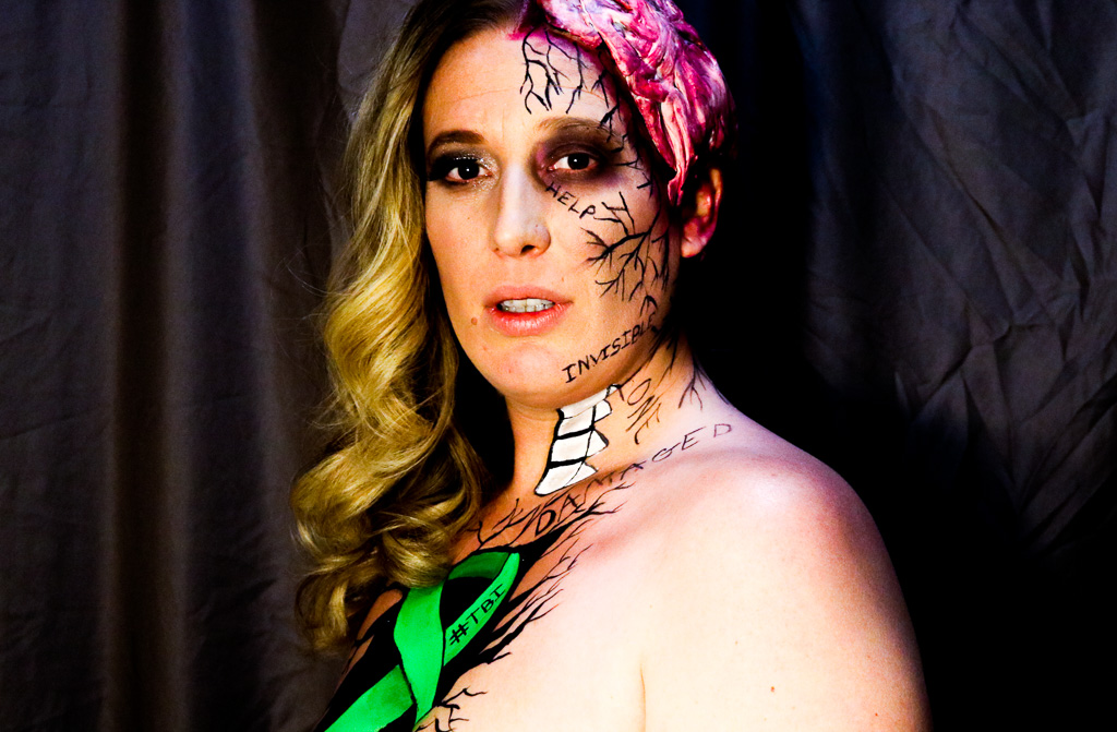 Nikki Stang wearing makeup to simulate her brain injury visually.