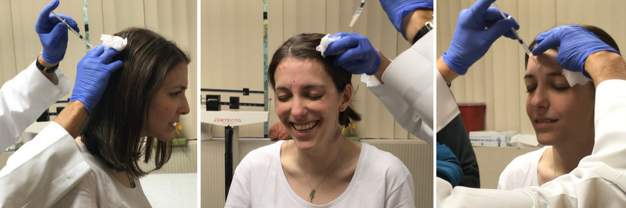 three photos of the author receiving botox injections in various points in her head and neck