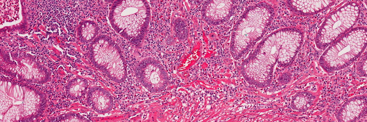 Scientists Discover New Organ That May Allow Cancer to Spread Rapidly Human cells under a microscope