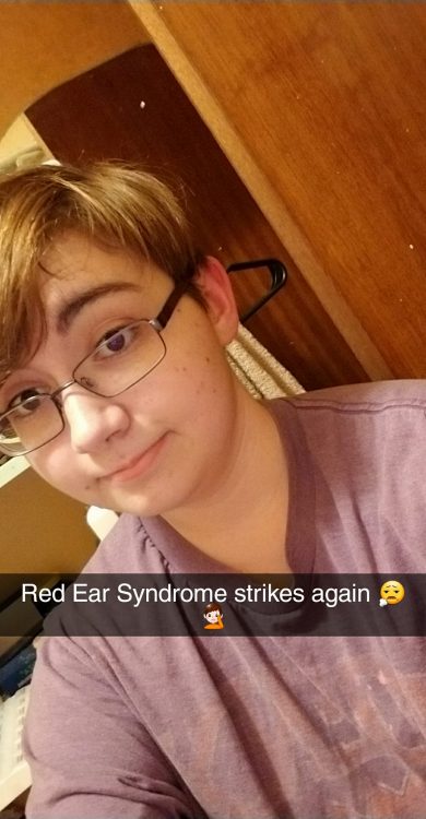 woman with flushed red ears and caption red ear syndrome strikes again