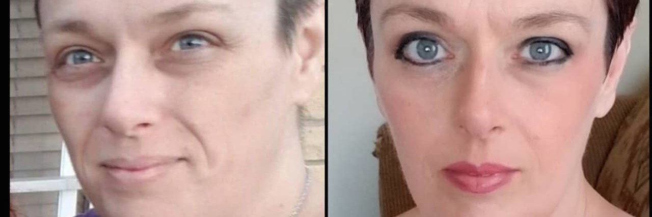 Two photos side by side, one of the writer feeling ill and the other of her feeling healthier.