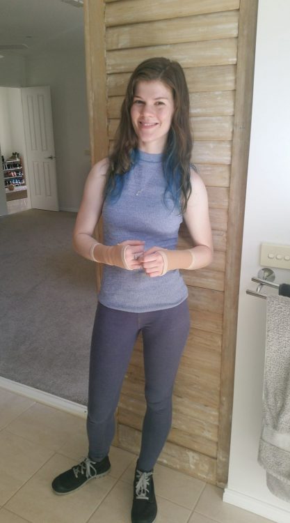 woman standing smiling wearing wrist braces