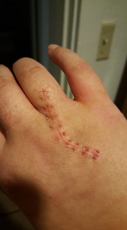 hand with car from stitches