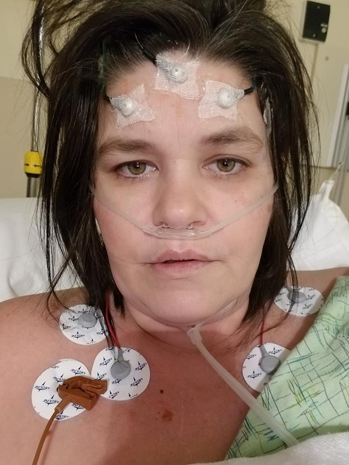 woman in the hospital with monitors attached to her face and chest