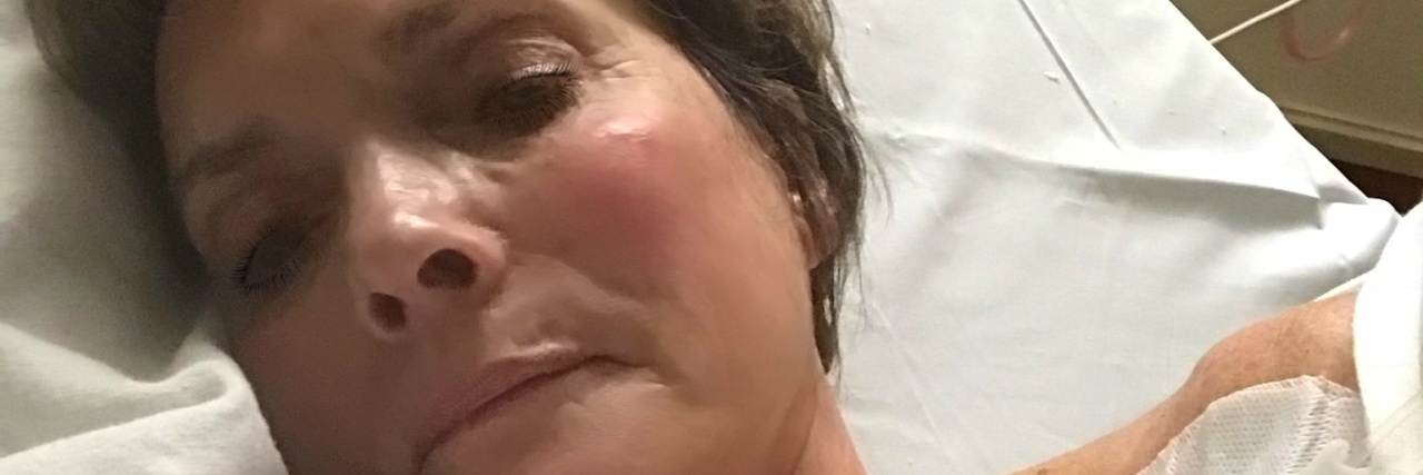 When My Illnesses Gave Me a New Kind of Compassion and Empathy A picture of the writer in a hospital bed with a large, clear bandage near her shoulder.