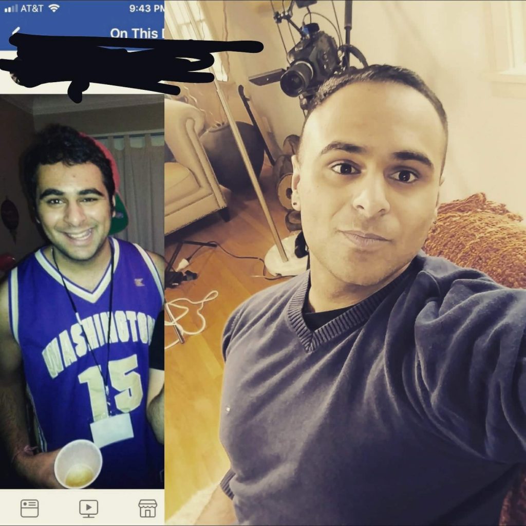 photo of a man with acne wearing a jersey, and photo of the same man with clear skin