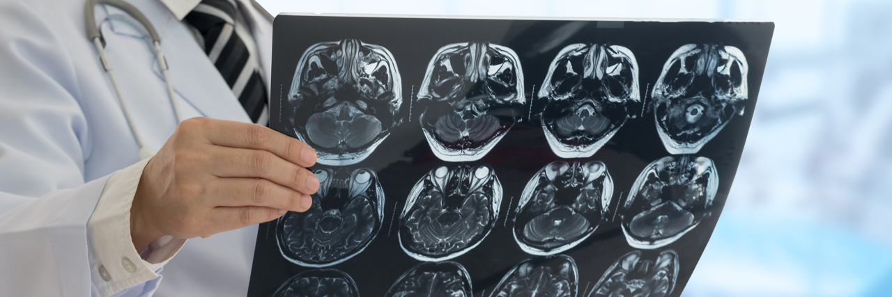 Disability and Being Taken Seriously by Doctors Doctor examining EEG image of brain.