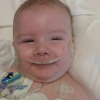 Two images, side by side, of baby after surgery. In one he is smiling, in the other he is sleeping. he has wires all over him.
