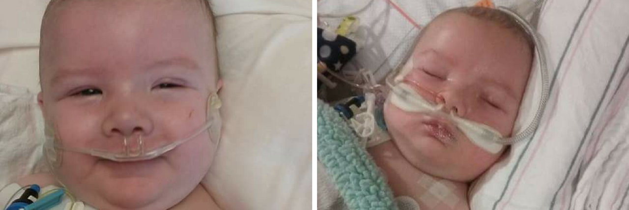 Using My Son's Bravery to Find Strength Two images, side by side, of baby after surgery. In one he is smiling, in the other he is sleeping. he has wires all over him.