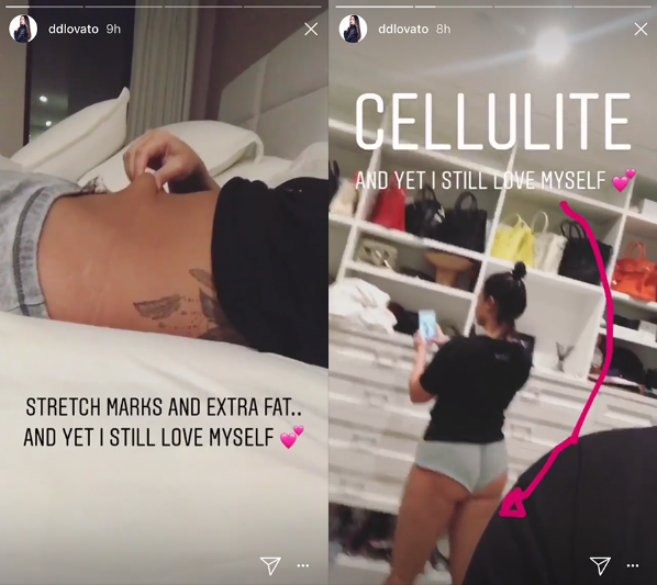 Tired of editing Insta photos, singer Demi Lovato bares 'cellulit