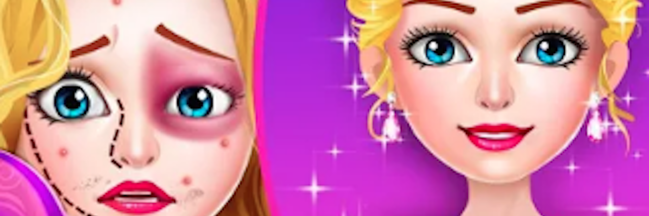 A graphic from the video game, comparing two images. The image to the left shows a princess with a purple hue over her eye and acne - along with surgical marking. The right image shows her looking "glamorous" and ball ready.
