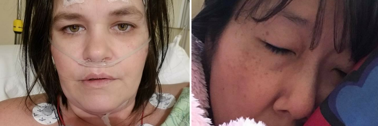 14 Symptoms of Dysautonomia in Photos left photo shows a woman in the hospital with monitors attached to her head and chest. right photo shows a woman sleeping under a pink blanket