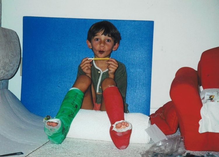 the author's son wearing two different leg casts