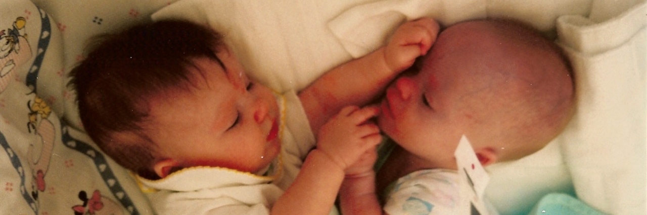 A Twin's Perspective on Coping With a New Down Syndrome Diagnosis