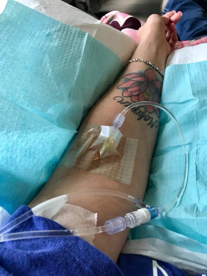 woman receiving IV infusion