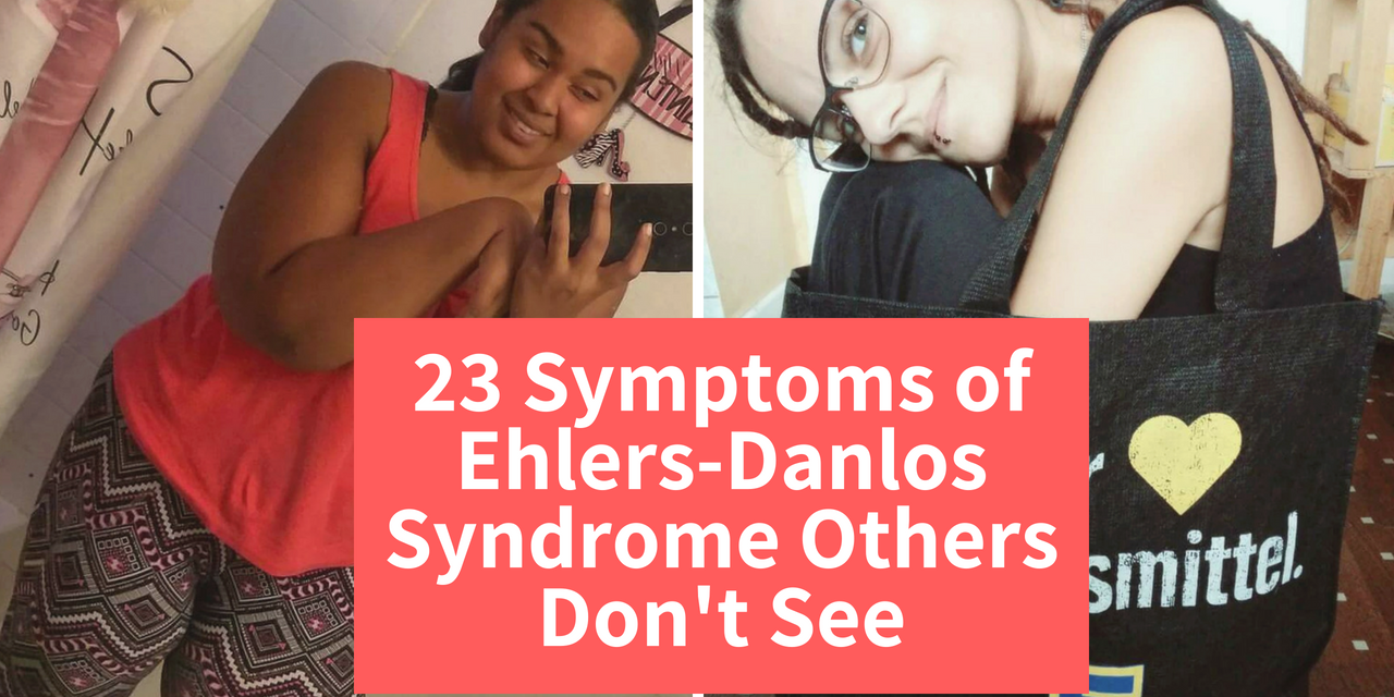 Photos Of Ehlers Danlos Syndrome Symptoms Others Dont See 4615