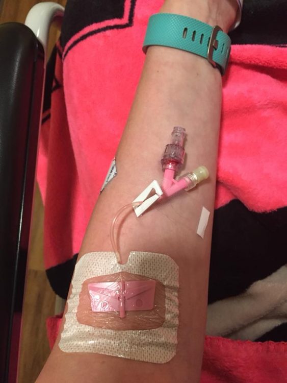 arm with iv 