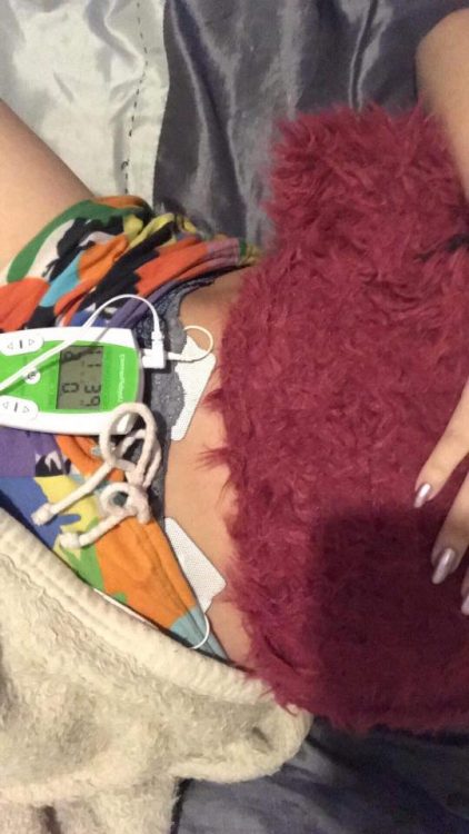 womans stomach with heating pad and tens machine