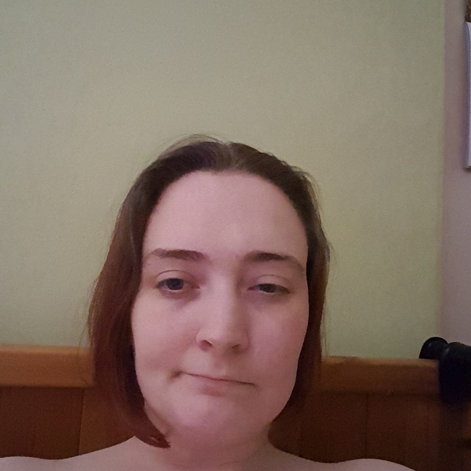 woman taking a selfie with half of her face drooping due to a hemiplegic migraine