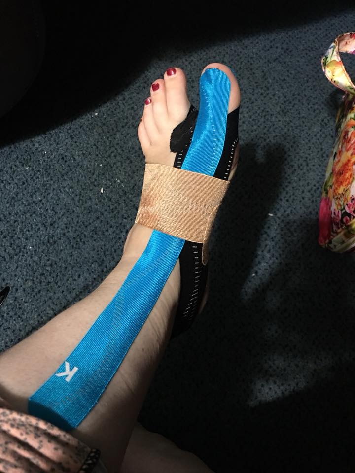 woman's foot wrapped with KT tape