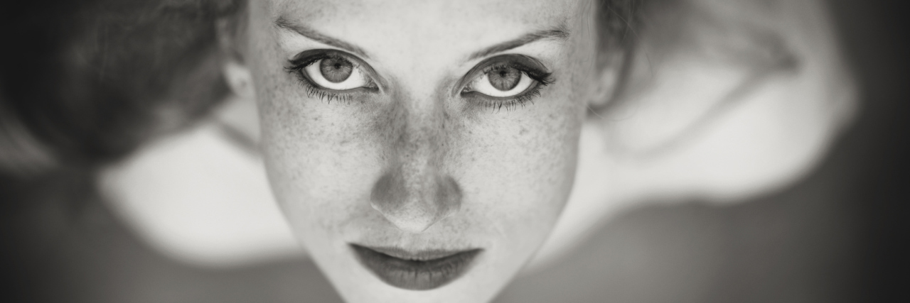 To the One Who Has Caused Me So Much Grief, My Ulcerative Colitis A black and white picture of a woman, the camera looking down on her face.