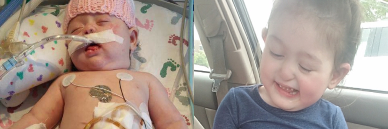Dear Parents: Remember This When Dealing With Your Kid's Doctors The author's daughter as a baby in the NICU, side by side with a photo of her a few years later, smiling
