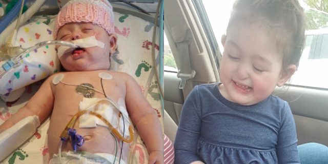 Dear Parents: Remember This When Dealing With Your Kid's Doctors The author's daughter as a baby in the NICU, side by side with a photo of her a few years later, smiling