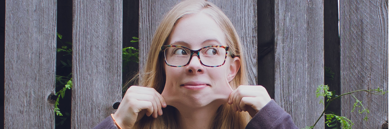 5 Things I Want You to Know About Ehlers-Danlos Syndrome A pictures of the writer pulling on her face's skin, showing how far it stretches.