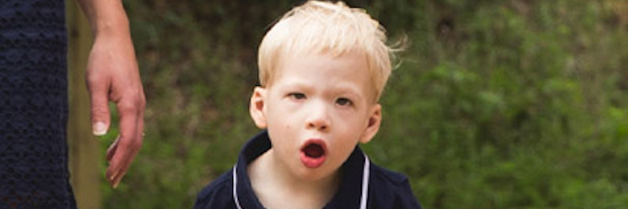 Opinions Should Not Drive Our Advocacy Efforts