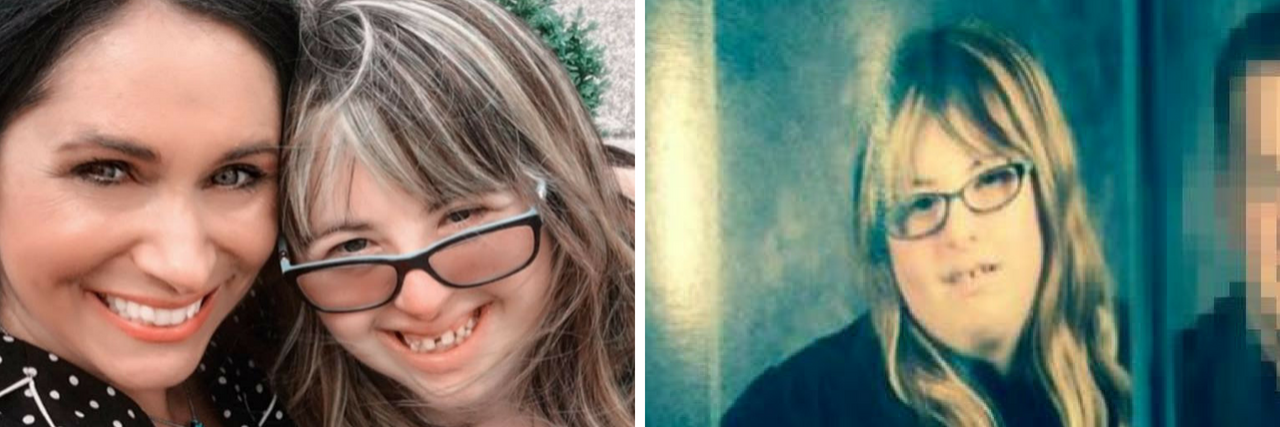 Teen With Down Syndrome Now Allowed to Walk With Class at Graduation