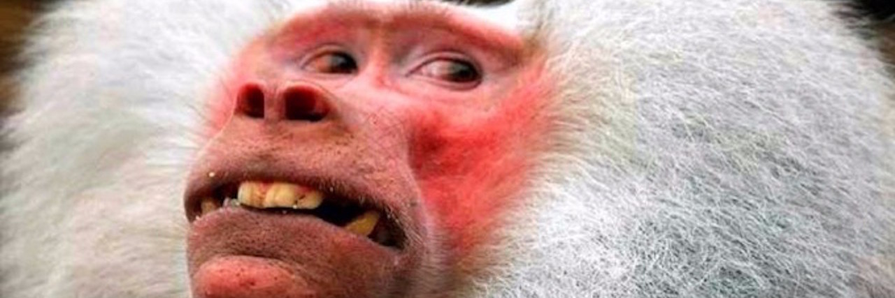 13 Memes That Describe Having a Flushed Face Due to Illness