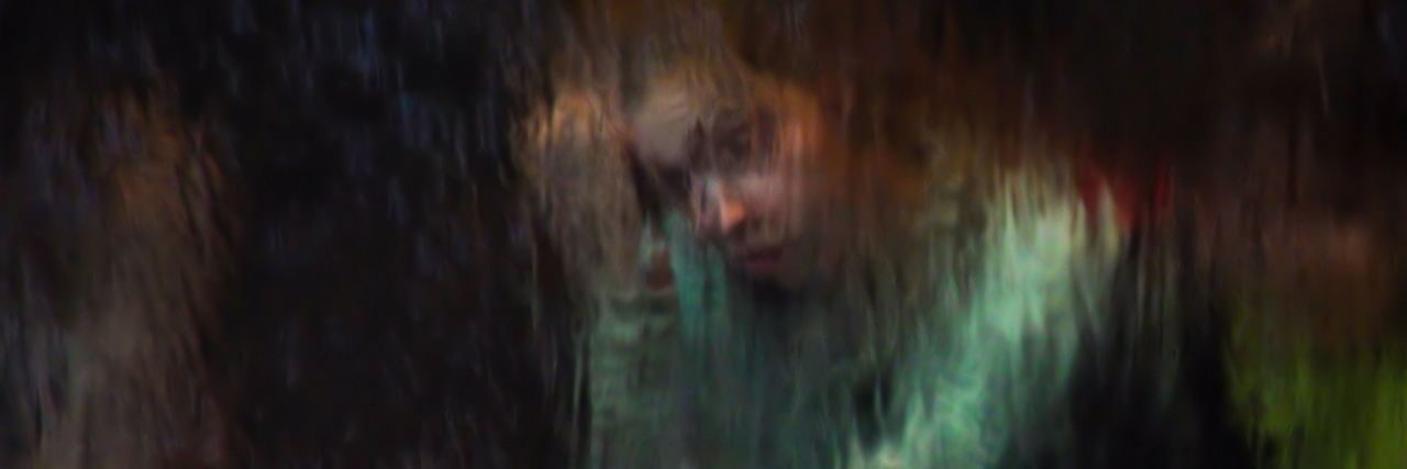 21 Symptoms of Ehlers-Danlos Syndrome Called 'No Big Deal' 21 Symptoms of Ehlers-Danlos Syndrome That Were Dismissed as 'No Big Deal'