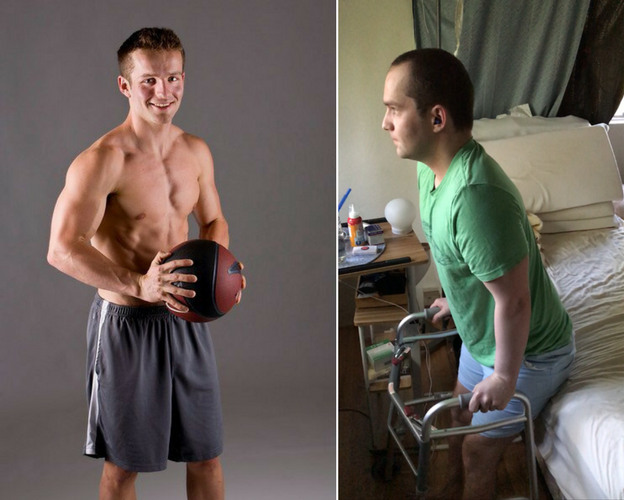 side by side photos of a man posing with a basketball, and a man getting out of bed using a walker
