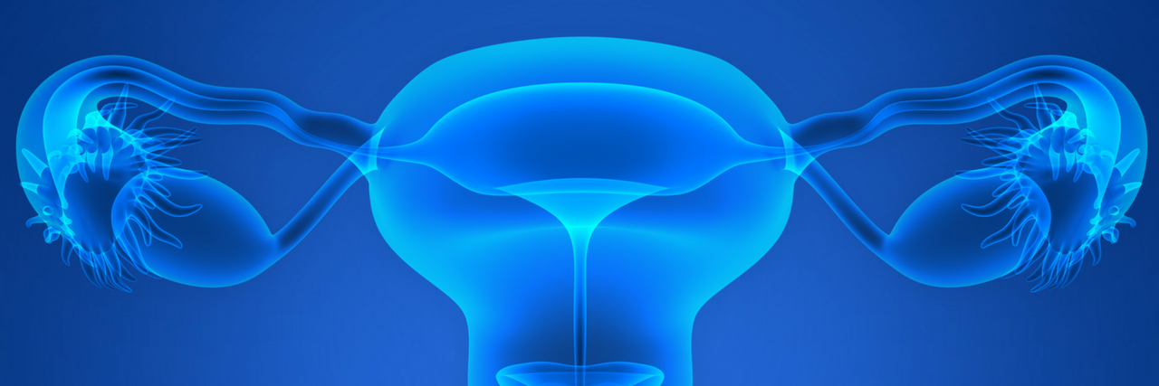 Researchers May Have Found a Cause and a Treatment for PCOS Illustration of the uterus/ovaries