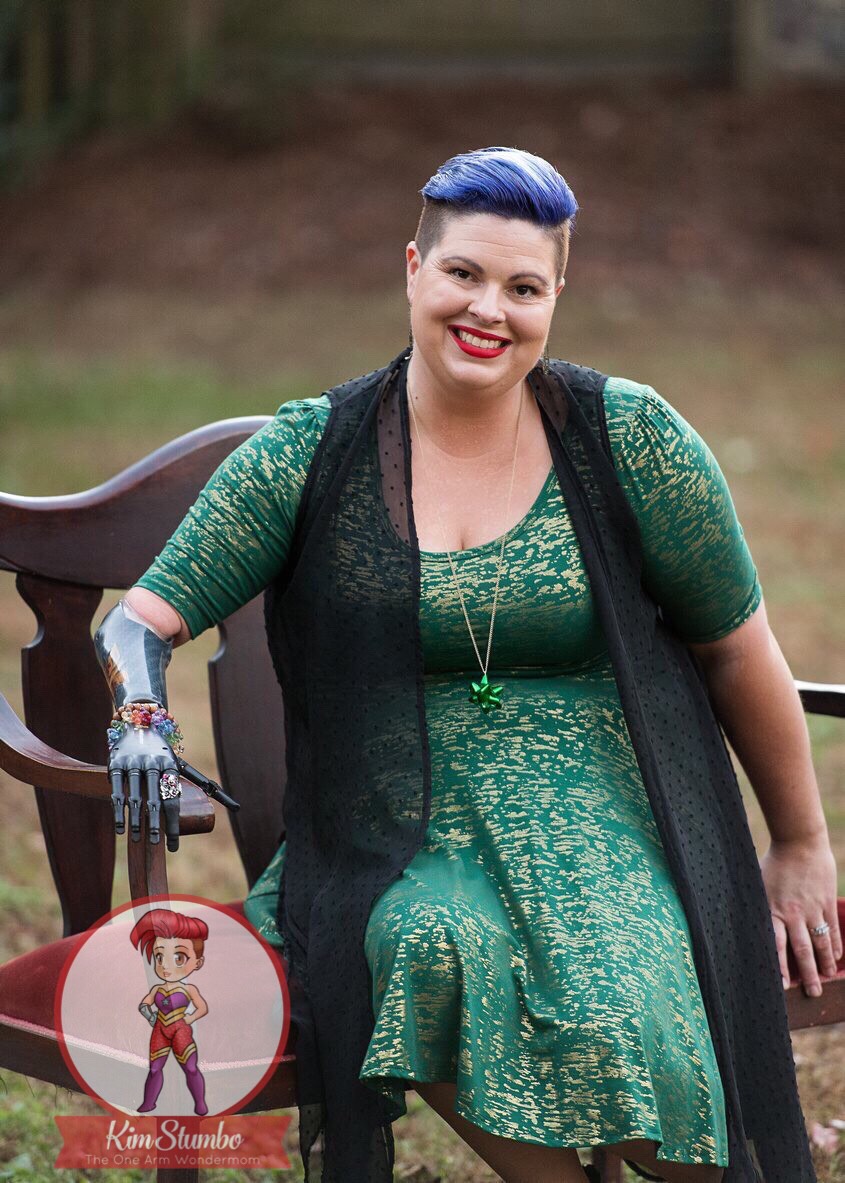 Kim Stumbo sits outside, wearing a green dress and showing her prosthetic hand..