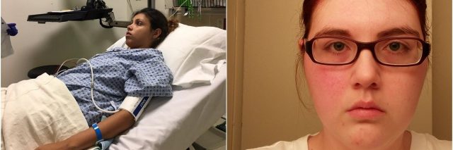 woman in hospital bed and woman with half of face rash