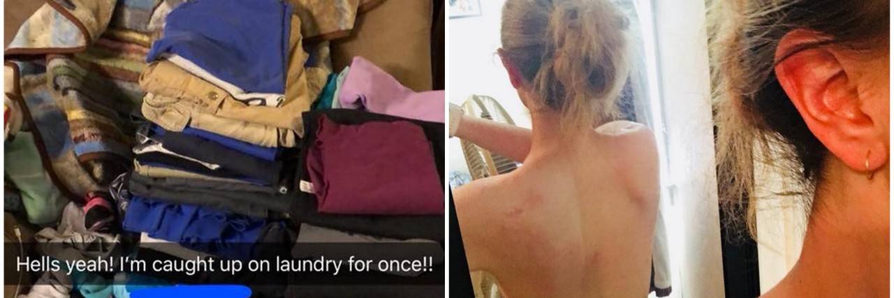 14 Side Effects of Chronic Pain We Never Talk About -- in Photos picture of pile of laundry, and photo of woman's back through mirror