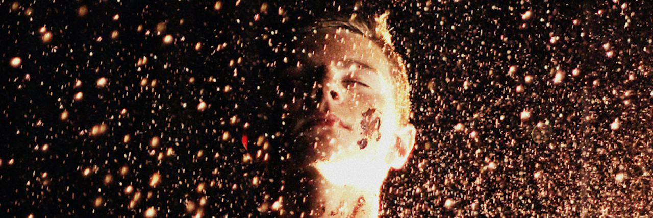 11 Hidden Signs of 'Quiet' Borderline Personality Disorder A young man with Quiet Borderline Personality Disorder stands in the dark with his face tilted up as he's illuminated by fire. 11 Hidden Signs of 'Quiet' Borderline Personality Disorder